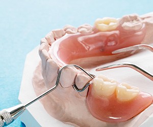 partial dentures on model teeth