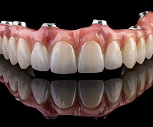 implant dentures with a black background