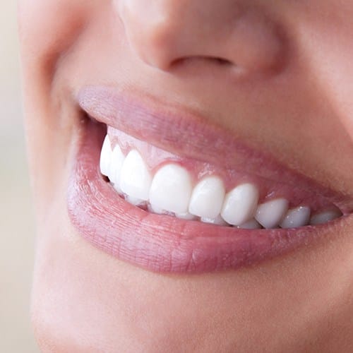 Closeup of healthy smile after gum grafting