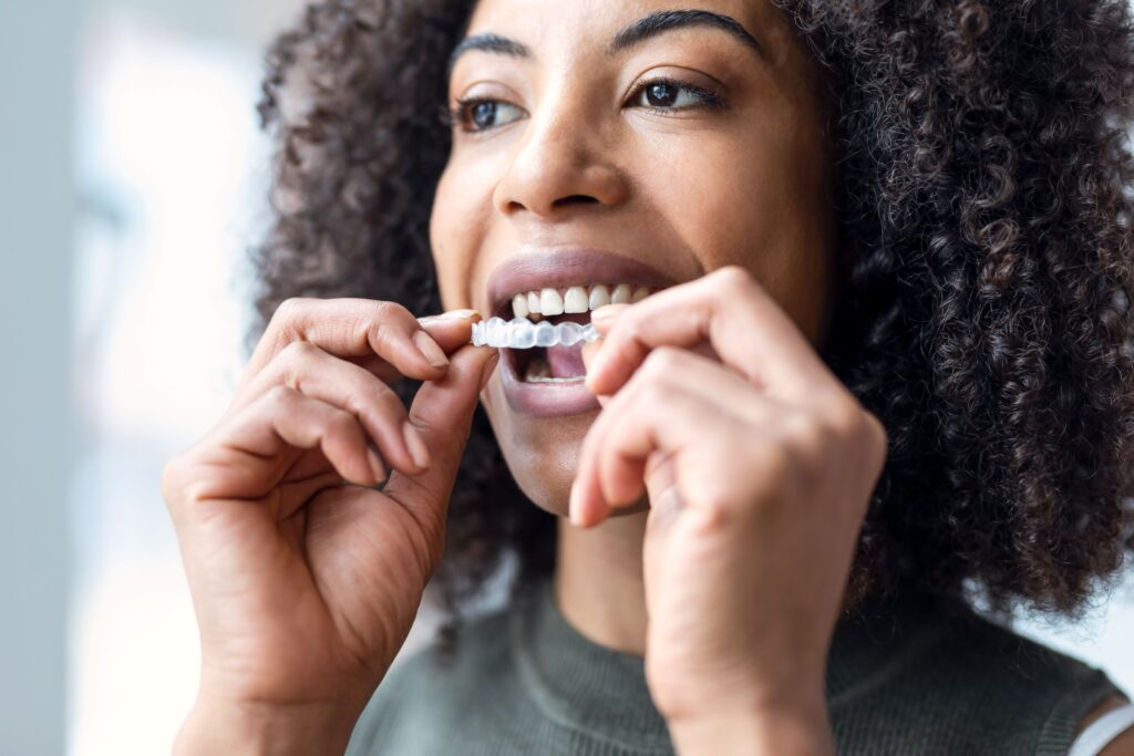 Woman inserting Invisalign over her upper arch